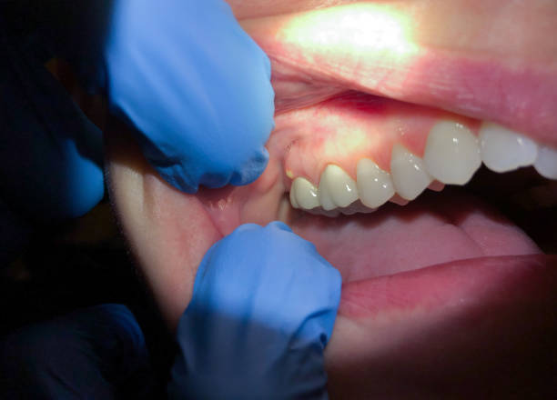 Best Broken or Chipped Tooth Repair in Dolton, IL