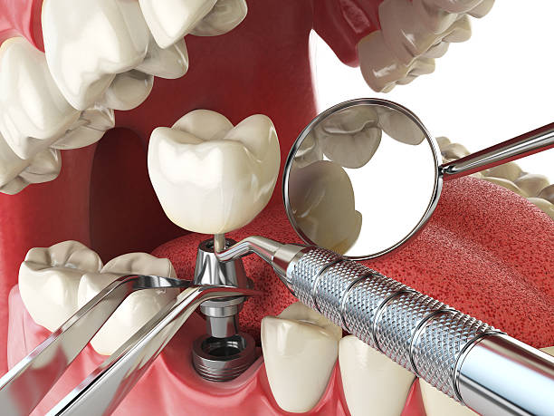 Best Emergency Orthodontic Repairs in Dolton, IL